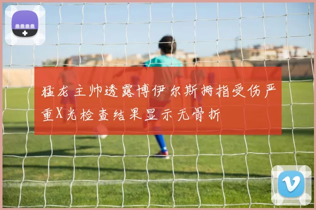 猛龙主帅透露博伊尔斯拇指受伤严重X光检查结果显示无骨折